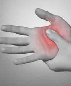 hand-gout-example
